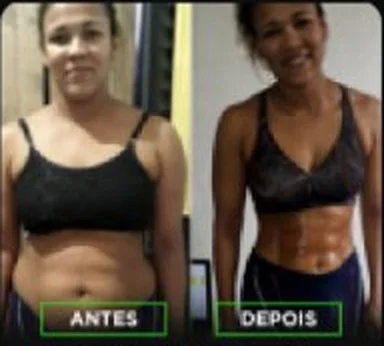 Antes e depois de Arnalda