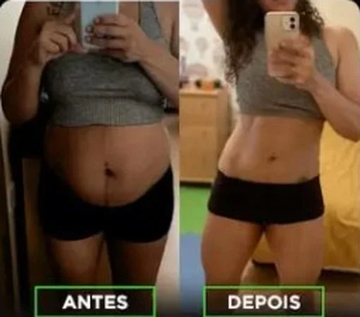 Antes e depois de Caroline